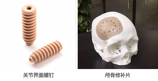 關(guān)節(jié)界面螺釘